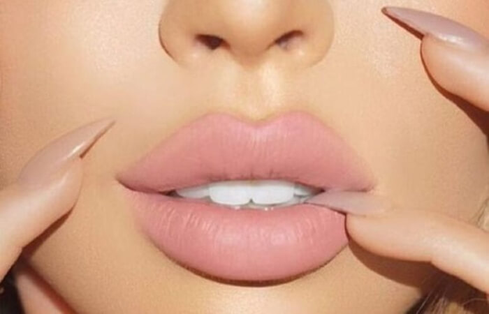 فيلر الشفايف