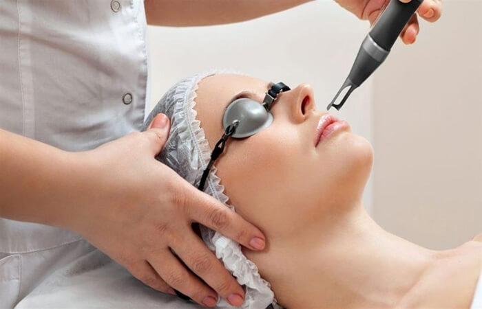 كيو سويتش ليزر