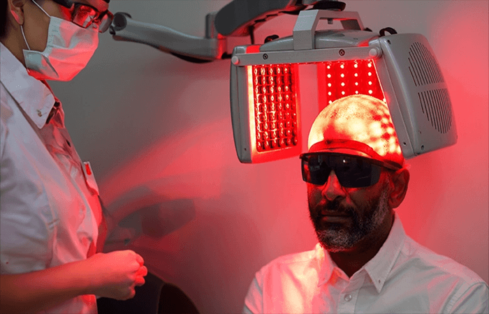 علاج تساقط الشعر بالليزر